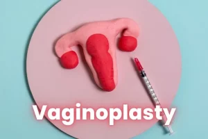 vaginoplasty-picture